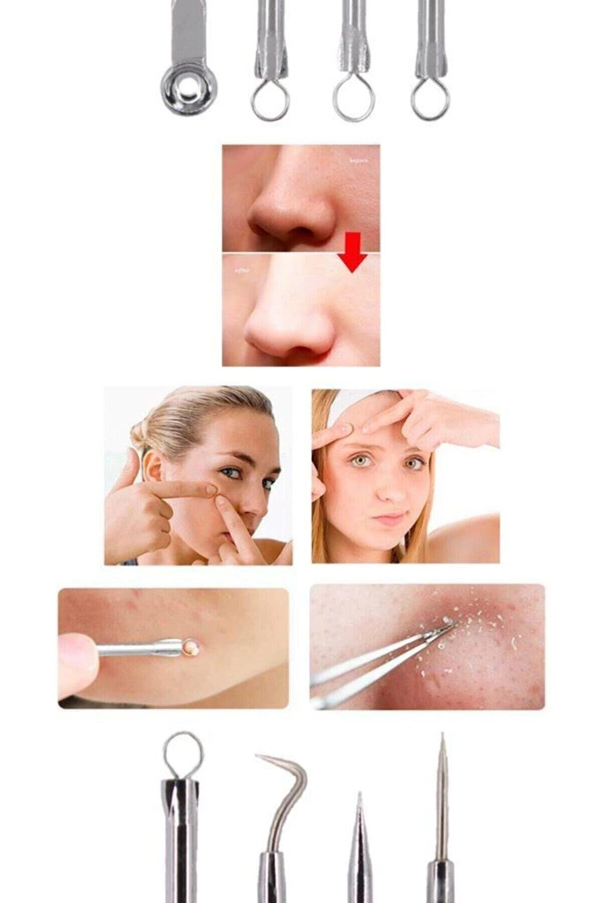 4 Lü Kutulu Paslanmaz Komedon Akne - Siyah Nokta Temizleyici Set